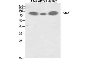 Western Blotting (WB) image for anti-Signal Transducer and Activator of Transcription 3 (Acute-Phase Response Factor) (STAT3) (Tyr705) antibody (ABIN5961851)
