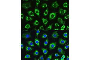 Immunofluorescence analysis of L929 cells using L1 antibody (ABIN6134555, ABIN6137248, ABIN6137250 and ABIN6215529) at dilution of 1:100.