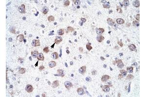 RALY antibody was used for immunohistochemistry at a concentration of 4-8 ug/ml to stain Neural cells (arrows) in Human Brain.