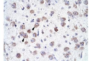 RALY antibody was used for immunohistochemistry at a concentration of 4-8 ug/ml to stain Neural cells (arrows) in Human Brain. (Raly anticorps  (N-Term))