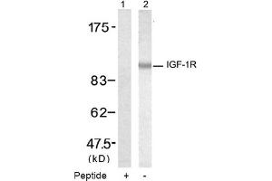 Image no. 2 for anti-Insulin-Like Growth Factor 1 Receptor (IGF1R) (Tyr1346) antibody (ABIN319345) (IGF1R anticorps  (Tyr1346))