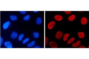Immunofluorescence analysis of 293T cells using MonoMethyl-Histone H3-K9 Polyclonal Antibody (Histone 3 anticorps  (meLys9))
