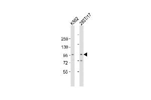 All lanes : Anti-Rai17 Antibody  at 1:2000 dilution Lane 1: K562 whole cell lysates Lane 2: 293T/17 whole cell lysates Lysates/proteins at 20 μg per lane. (ZMIZ1 anticorps  (C-Term))
