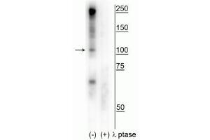 Western blot of human T47D cell lysate showing specific immunolabeling of the ~100 kDa CtIP phosphorylated at Ser327 in the first lane (-). (Retinoblastoma Binding Protein 8 anticorps  (pSer327))