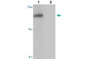 Western blot analysis of SDHAF2 in rat liver tissue with SDHAF2 polyclonal antibody  at 1 ug/mL in (lane 1) the absence and (lane 2) the presence of blocking peptide. (Sdhaf2 anticorps  (N-Term))