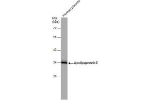 WB Image Human tissue extract (30 μg) was separated by 10% SDS-PAGE, and the membrane was blotted with Apolipoprotein E antibody , diluted at 1:1000. (APOE anticorps  (N-Term))