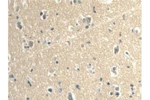 Detection of CALML3 in Human Cerebrum Tissue using Polyclonal Antibody to Calmodulin Like Protein 3 (CALML3) (CALML3 anticorps  (AA 1-149))