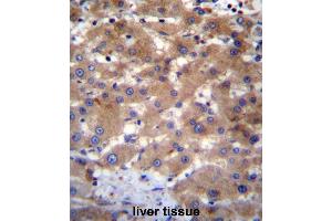 UBE2NL Antibody (N-term) immunohistochemistry analysis in formalin fixed and paraffin embedded human liver tissue followed by peroxidase conjugation of the secondary antibody and DAB staining. (UBE2NL anticorps  (N-Term))