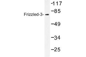 Image no. 1 for anti-Frizzled Family Receptor 3 (FZD3) antibody (ABIN317640) (FZD3 anticorps)