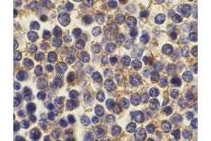 Immunohistochemistry of BCMA in human spleen cells with BCMA antibody at 10 μg/ml.