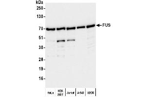 Western Blotting (WB) image for anti-Fused in Sarcoma (FUS) (AA 400-450) antibody (ABIN7453433)
