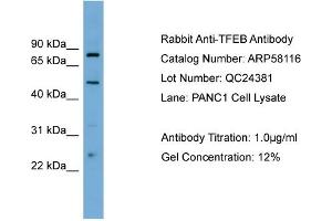 WB Suggested Anti-TFEB  Antibody Titration: 0. (TFEB anticorps  (Middle Region))