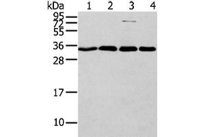 Western Blotting (WB) image for anti-Chromobox Homolog 7 (CBX7) antibody (ABIN5960243)