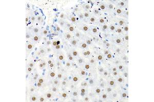 Immunohistochemistry of paraffin-embedded rat liver using PTBP1 antibody at dilution of 1:100 (40x lens).