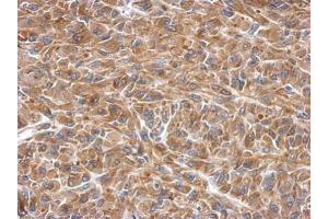 IHC-P Image Immunohistochemical analysis of paraffin-embedded U87 xenograft, using SLK, antibody at 1:500 dilution. (SLK anticorps)