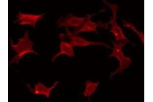 anti-Frizzled Family Receptor 3 (FZD3) (Internal Region) antibody