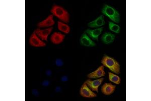 ABIN6261523 and ABIN6277133 staining Hela cells by IF/ICC. (ELSPBP1 anticorps  (C-Term))