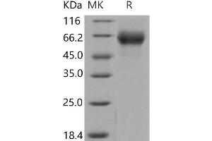 Western Blotting (WB) image for Fibroblast Growth Factor Receptor 4 (FGFR4) protein (His tag) (ABIN7320371)
