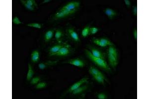 Immunofluorescent analysis of Hela cells using ABIN7169699 at dilution of 1:100 and Alexa Fluor 488-congugated AffiniPure Goat Anti-Rabbit IgG(H+L)