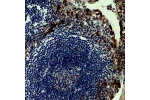 Immunohistochemical analysis of CD62P staining in human tonsil formalin fixed paraffin embedded tissue section. (P-Selectin anticorps  (N-Term))