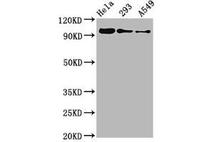 Western Blot Positive WB detected in Hela whole cell lysate ? (Recombinant FOXO3 anticorps  (pSer253))