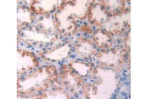 Used in DAB staining on fromalin fixed paraffin- embedded kidney tissue (GLUD1 anticorps  (AA 334-556))