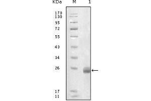 Western blot analysis using FBLN5 mouse mAb against truncated FBLN5-His recombinant protein.