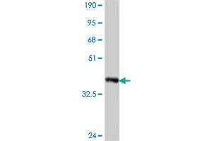 Western Blot detection against Immunogen (37. (MAML3 anticorps  (AA 1024-1131))