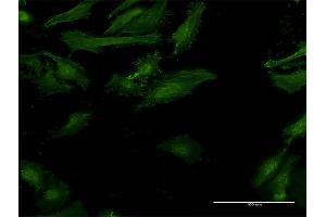 Immunofluorescence of monoclonal antibody to IFNGR2 on HeLa cell. (IFNGR2 anticorps  (AA 28-127))