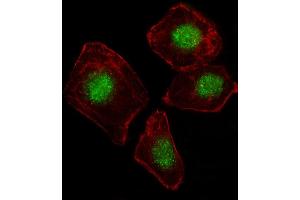 Fluorescent image of A549 cell stained with ZN Antibody (N-term) (ABIN1539171 and ABIN2849572). (ZNF187 anticorps  (N-Term))