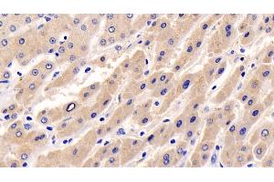 Detection of ERK1 in Human Liver Tissue using Monoclonal Antibody to Extracellular Signal Regulated Kinase 1 (ERK1)