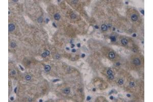 Used in DAB staining on fromalin fixed paraffin-embedded Liver tissue (Hepcidin anticorps  (AA 25-84))