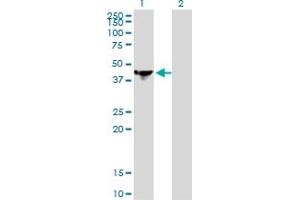 Western Blot analysis of NCK1 expression in transfected 293T cell line by NCK1 monoclonal antibody (M01), clone 1A1.