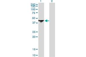 Western Blot analysis of NCK1 expression in transfected 293T cell line by NCK1 monoclonal antibody (M01), clone 1A1. (NCK1 anticorps  (AA 185-294))
