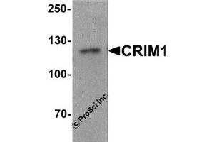 Western Blotting (WB) image for anti-Cysteine Rich Transmembrane BMP Regulator 1 (Chordin-Like) (CRIM1) (C-Term) antibody (ABIN1030343) (CRIM1 anticorps  (C-Term))