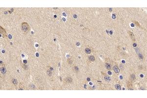 Detection of TNFa in Porcine Cerebrum Tissue using Polyclonal Antibody to Tumor Necrosis Factor Alpha (TNFa)