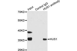 Immunoprecipitation analysis of 200ug extracts of 293T cells using 1ug HUS1 antibody (ABIN1876595). (HUS1 anticorps)