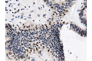 Immunohistochemical staining of paraffin-embedded Human Kidney tissue using anti-QPRT mouse monoclonal antibody.