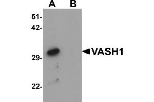 Western blot analysis of VASH1 in human brain tissue lysate with VASH1 antibody at 1 µg/mL in (A) the absence and (B) the presence of blocking peptide. (VASH1 anticorps  (C-Term))