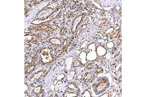 IHC analysis of RAB7/RAB7A using anti-RAB7/RAB7A antibody (ABIN7600597). (RAB7A anticorps  (AA 21-177))