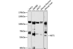 anti-Neuroepithelial Cell Transforming 1 (NET1) (AA 1-300) antibody