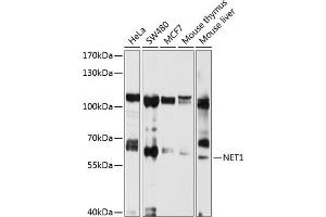 Western blot analysis of extracts of various cell lines, using NET1 antibody (ABIN3021741, ABIN3021742, ABIN1513253 and ABIN6215710) at 1:1000 dilution. (NET1 anticorps  (AA 1-300))