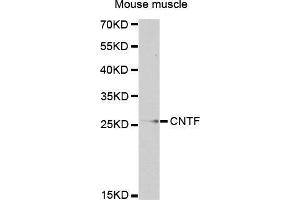 Western Blotting (WB) image for anti-Ciliary Neurotrophic Factor (CNTF) (AA 1-200) antibody (ABIN3015705) (CNTF anticorps  (AA 1-200))