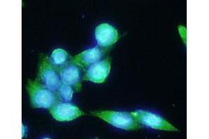 ICC/IF analysis of PSMA in LNCaP cells line, stained with DAPI (Blue) for nucleus staining and monoclonal anti-human PSMA antibody (1:100) with goat anti-mouse IgG-Alexa fluor 488 conjugate (Green).