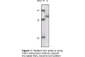 Western Blotting (WB) image for anti-Ribosomal Protein S6 Kinase, 90kDa, Polypeptide 1 (RPS6KA1) (truncated) antibody (ABIN2464100) (RPS6KA1 anticorps  (truncated))