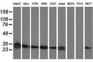 Western blot analysis of extracts (35 µg) from 9 different cell lines by using anti-SPR monoclonal antibody. (SPR anticorps)
