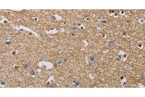 Immunohistochemistry of paraffin-embedded Human brain using PIP4K2A Polyclonal Antibody at dilution of 1:40