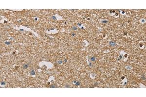 Immunohistochemistry of paraffin-embedded Human brain using PIP4K2A Polyclonal Antibody at dilution of 1:40 (PIP4K2A anticorps)