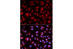 Immunofluorescence analysis of U2OS cell using PLK1 antibody. (PLK1 anticorps  (AA 304-603))