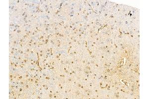 ABIN6255261 and ABIN6267114 at 1/100 staining Rat brain tissue by IHC-P.